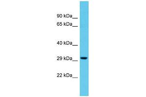 Host: Rabbit Target Name: TTLL11 Sample Type: THP-1 Whole Cell lysates Antibody Dilution: 1. (TTLL11 antibody  (N-Term))