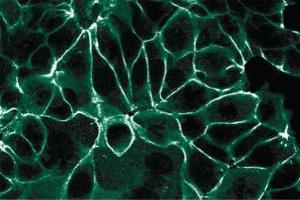 Immunofluorescence staining of MCF7 cells. (JUP antibody  (AA 553-738))