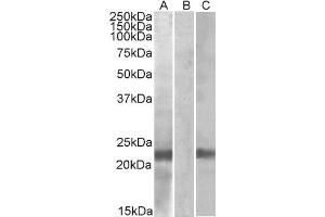 HEK293 lysate (10ug protein in RIPA buffer) overexpressing Human CST8 (RC210130) with C-terminal MYC tag probed with ABIN571108 (1ug/ml) in Lane A and probed with anti-MYC Tag (1/1000) in lane C. (CST8 antibody  (AA 100-112))