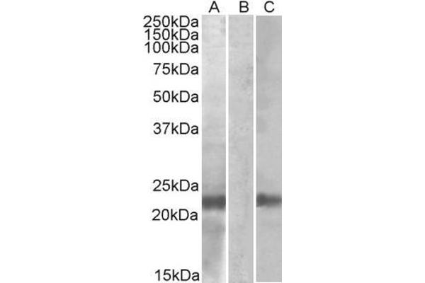 CST8 antibody  (AA 100-112)