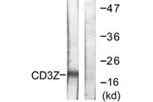 Western blot analysis of extracts from Jurkat cells, treated with UV 15', using CD3 zeta (Ab-42) Antibody.