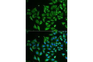 Immunofluorescence analysis of HeLa cells using CLEC3B/Tetranectin antibody (ABIN6130014, ABIN6138710, ABIN6138712 and ABIN6222056).