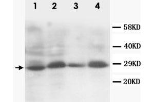 Western Blot analysis of SSX2 expression from cell extracts with SSX2 polyclonal antibody . (SSX2 antibody  (C-Term))