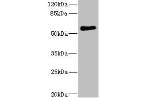 Western blot All lanes: FCRL2 antibody at 1. (FCRL2 antibody  (AA 20-100))