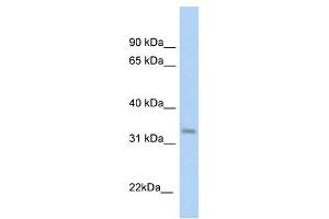 KHK antibody used at 1 ug/ml to detect target protein. (Ketohexokinase antibody)