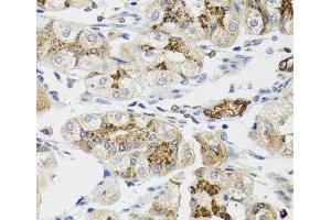 Immunohistochemistry of paraffin-embedded Human stomach using LFNG Polyclonal Antibody at dilution of 1:100 (40x lens).