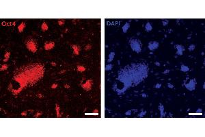 Oct-4 antibody (pAb) tested by Immunofluorescence Mouse embryonic stem cells (mESCs) grown on mouse embryonic fibroblast feeder cells (MEFs) were fixed with 4 % paraformaldehyde for 10 minutes at room temperature. (OCT4 antibody)