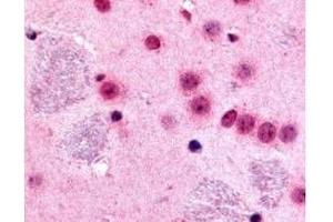 Immunohistochemistry (IHC) image for anti-GLI Family Zinc Finger 2 (GLI2) (Internal Region) antibody (ABIN129624)
