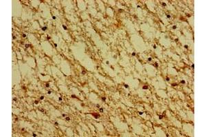 Immunohistochemistry of paraffin-embedded human brain tissue using ABIN7142640 at dilution of 1:100 (Serotonin Receptor 4 antibody  (AA 316-388))