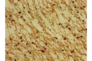 Immunohistochemistry of paraffin-embedded human brain tissue using ABIN7142640 at dilution of 1:100