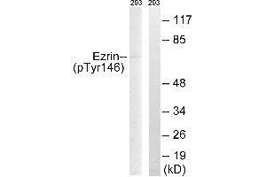 Western blot analysis of extracts from 293 cells, treated with UV (15mins), using Ezrin (Phospho-Tyr146) antibody. (Ezrin antibody  (pTyr146))