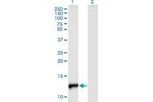 Western Blot analysis of CYP24A1 expression in transfected 293T cell line by CYP24A1 monoclonal antibody (M02), clone 1E1.