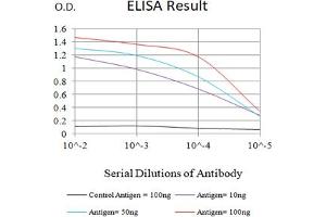 Black line: Control Antigen (100 ng),Purple line: Antigen (10 ng), Blue line: Antigen (50 ng), Red line:Antigen (100 ng) (Adenosine Triphosphate antibody  (AA 44-220))