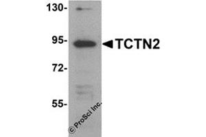 Western Blotting (WB) image for anti-Tectonic Family Member 2 (TCTN2) (C-Term) antibody (ABIN1030725)