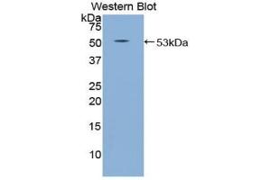 Western blot analysis of the recombinant protein. (SEMA4B antibody  (AA 644-832))