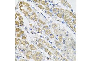 Immunohistochemistry of paraffin-embedded human stomach using SDC2 antibody at dilution of 1:100 (x40 lens). (Syndecan 2 antibody)