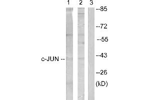 Immunohistochemistry analysis of paraffin-embedded human testis tissue using c-Jun (Ab-231) antibodyWestern blot analysis of extracts from Jurkat cells treated with Paclitaxel (1uM, 60mins) (line 1) and HuvEc cells treated with EGF (200ng/ml, 15mins) (line 2), using c-Jun (Ab-231) antibody (C-JUN antibody)