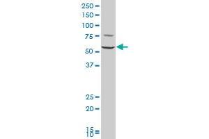 FARSLA polyclonal antibody (A01), Lot # 060102JC01 Western Blot analysis of FARSLA expression in Jurkat . (Phenylalanyl-tRNA Synthetase, alpha Subunit (FARSA) (AA 101-201) antibody)