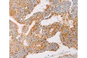 Immunohistochemistry (IHC) image for anti-Tyrosyl-tRNA Synthetase 2, Mitochondrial (YARS2) antibody (ABIN2422815) (YARS2 antibody)
