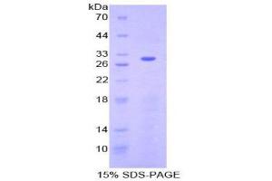SDS-PAGE (SDS) image for Activating Transcription Factor 6 (ATF6) (AA 423-646) protein (His tag) (ABIN2123906) (ATF6 Protein (AA 423-646) (His tag))