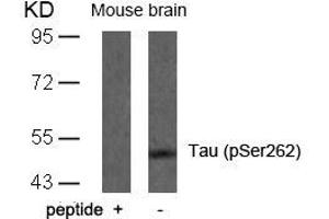 Western blot analysis of extracts from mouse brain tissue using Tau(Phospho-Ser262) Antibody and the same antibody preincubated with blocking peptide. (MAPT antibody  (pSer262))
