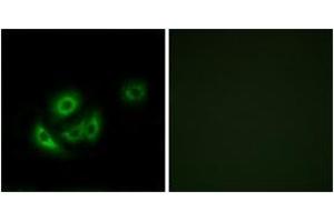 Immunofluorescence analysis of A549 cells, using MRPL11 Antibody. (MRPL11 antibody  (AA 21-70))