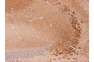 Indirect immunostaining of PFA fixed mouse brain section with anti-endophilin (dilution 1 : 200; red) and guinea pig anti-SV 2C (cat. (SH3G2 antibody  (AA 256-276))