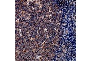Immunohistochemical analysis of Tryptase delta staining in human tonsil formalin fixed paraffin embedded tissue section.