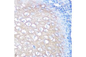Immunohistochemistry of paraffin-embedded human esophageal using [KO Validated] CD168/RHAMM Rabbit mAb  at dilution of 1:100 (40x lens). (HMMR antibody)