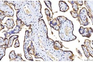 IHC analysis of Poliovirus Receptor/PVR using anti-Poliovirus Receptor/PVR antibody (ABIN7601071).