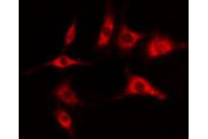 ABIN6274403 staining COLO205 cells by IF/ICC. (DOK6 antibody  (Internal Region))
