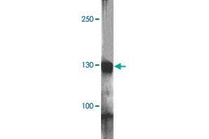 Western blot analysis of RC3H1 in HeLa cell lysate with RC3H1 polyclonal antibody  at 1 ug/mL. (RC3H1 antibody  (AA 1040-1090))