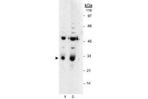 Western blot analysis of HPGD in LoVo whole cell lysates using HPGD polyclonal antibody .