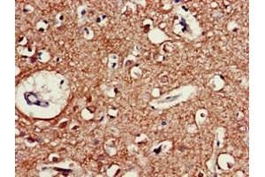 Immunohistochemistry of paraffin-embedded human brain tissue using ABIN7160353 at dilution of 1:100 (CHRM5 antibody  (AA 220-427))