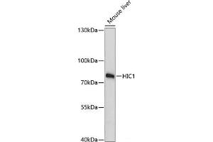 Western blot analysis of extracts of Mouse liver using HIC1 Polyclonal Antibody at dilution of 1:3000.