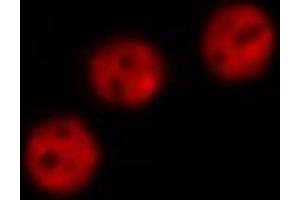ABIN6274105 staining Hela by IF/ICC. (AKAP8 antibody  (Internal Region))