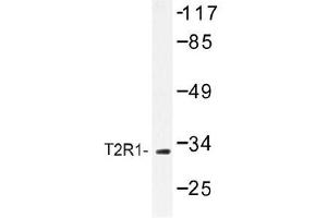 Image no. 1 for anti-Taste Receptor, Type 2, Member 1 (TAS2R1) antibody (ABIN317775) (TAS2R1 antibody)