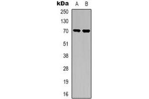Western blot analysis of TGFBR2 expression in A549 (A), NIH3T3 (B) whole cell lysates. (TGFBR2 antibody)