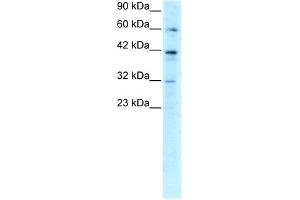 WB Suggested Anti-E2F4 Antibody Titration: 0. (E2F4 antibody  (C-Term))