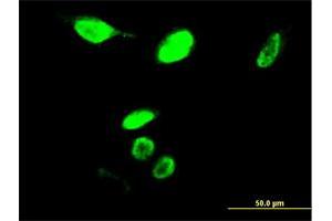 Immunofluorescence of monoclonal antibody to MYBL2 on HeLa cell. (MYBL2 antibody  (AA 601-700))