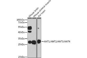Western blot analysis of extracts of various cell lines, using /// antibody (ABIN7265627) at 1:1000 dilution. (ANT1+ANT2+ANT3+ANT4 (C-Term) antibody)