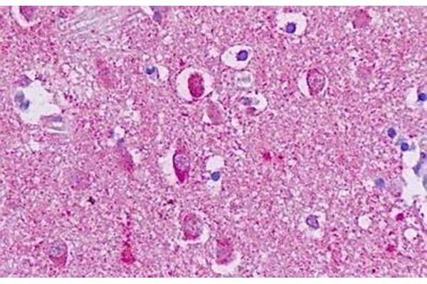 GPR56 antibody  (Cytoplasmic Domain)