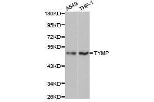 Western Blotting (WB) image for anti-Thymidine Phosphorylase (TYMP) antibody (ABIN1875239)