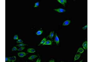 Immunofluorescent analysis of Hela cells using ABIN7146119 at dilution of 1:100 and Alexa Fluor 488-congugated AffiniPure Goat Anti-Rabbit IgG(H+L) (CXCL11 antibody  (AA 22-94))