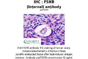 Image no. 1 for anti-Follicle Stimulating Hormone Receptor (FSHR) (Internal Region) antibody (ABIN1734475) (FSHR antibody  (Internal Region))