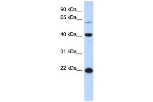 WB Suggested Anti-BLZF1 Antibody Titration: 0.