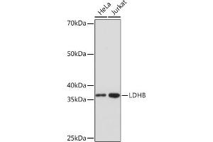 Western blot analysis of extracts of various cell lines, using LDHB Rabbit mAb (ABIN7268170) at 1:1000 dilution.