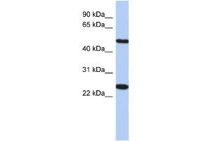 Western Blotting (WB) image for anti-Transmembrane Protein 161B (TMEM161B) antibody (ABIN2459638) (TMEM161B antibody)