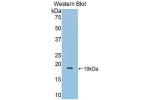 Western Blotting (WB) image for anti-Lecithin-Cholesterol Acyltransferase (LCAT) (AA 290-432) antibody (ABIN1859624) (LCAT antibody  (AA 290-432))