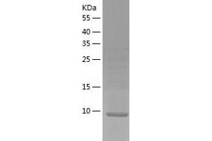 Western Blotting (WB) image for LSM3 Homolog, U6 Small Nuclear RNA Associated (LSM3) (AA 1-102) protein (His tag) (ABIN7286698) (LSM3 Protein (AA 1-102) (His tag))